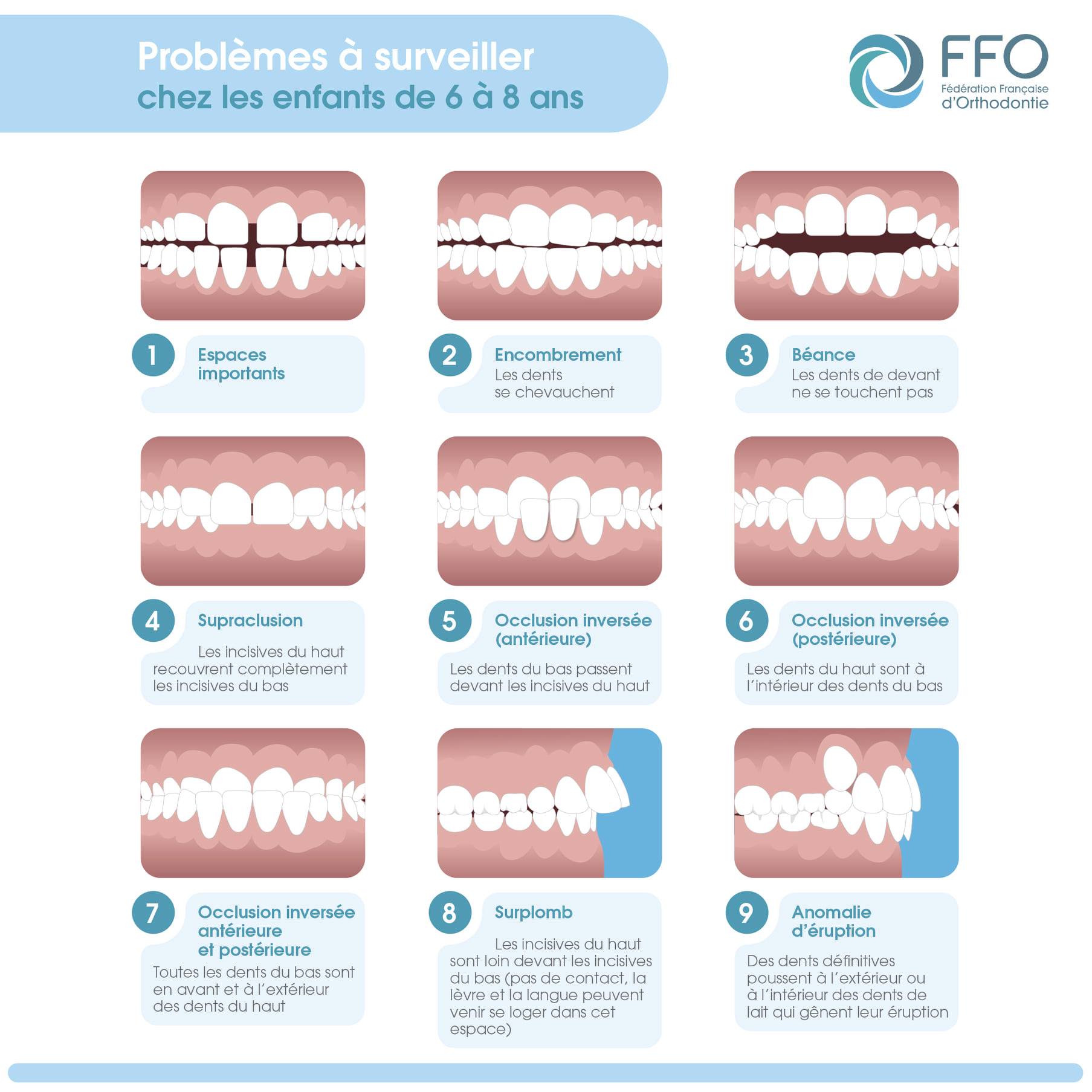 Les problèmes orthodontiques